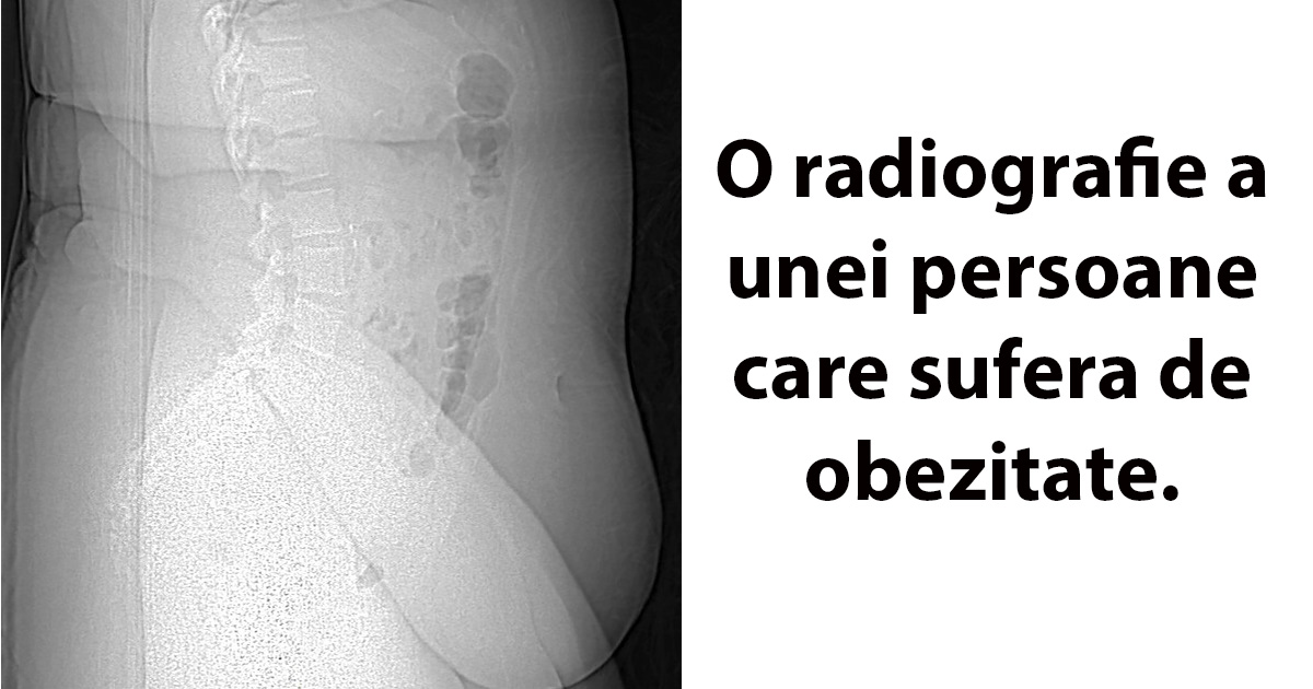 11 fotografii neașteptate ale corpului uman pe care nu le vedem în fiecare zi