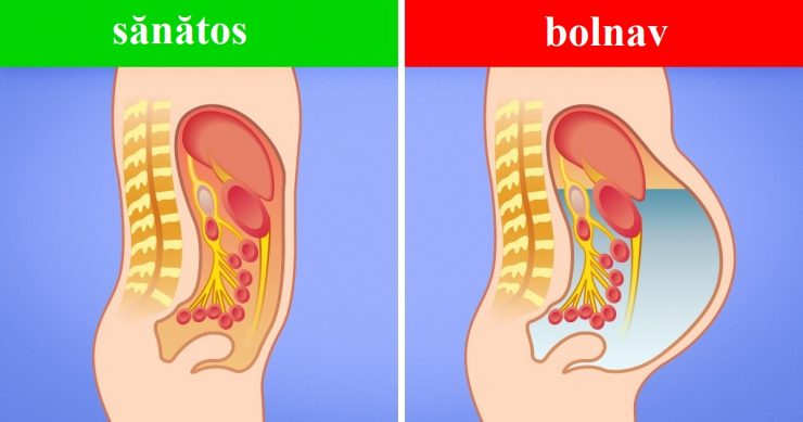 5 semne ale ficatului bolnav care trebuie să te trimită urgent la medic