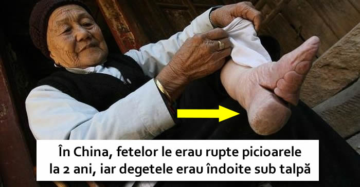 5 pericole uriase suportate de oameni de dragul frumuseții